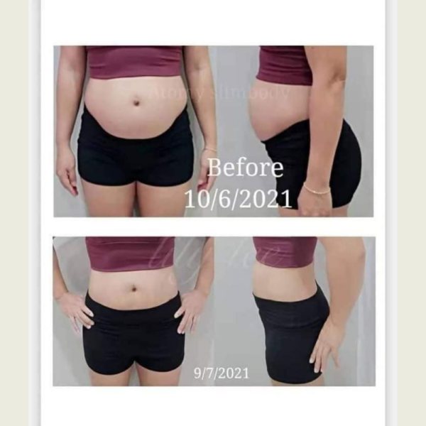 Applephenon Jelly Stick - Image 6